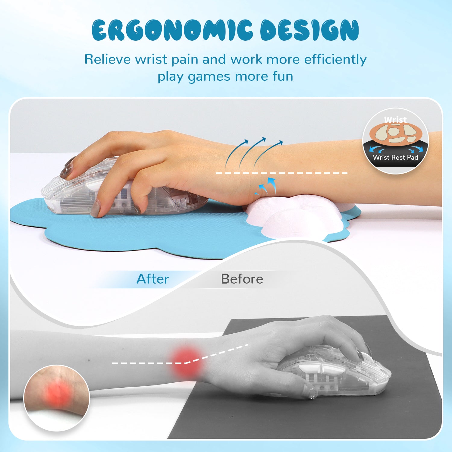 Before and after wrist pain relief using ergonomic cloud mouse pad.